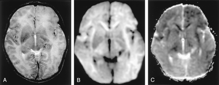 Fig 11.
