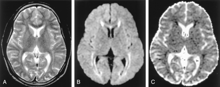Fig 16.