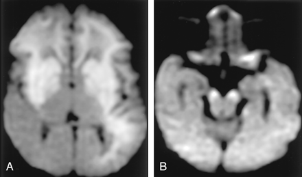 Fig 6.