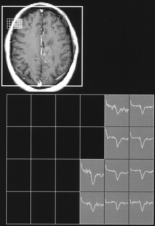 Fig 1.