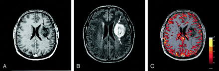 Fig 5.