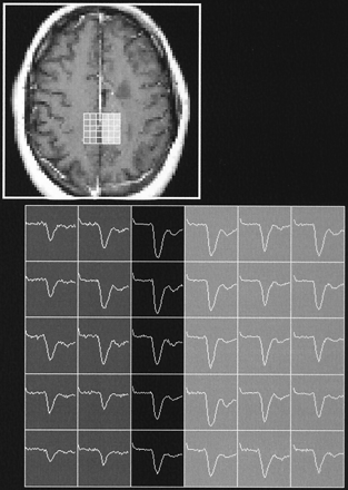 Fig 7.