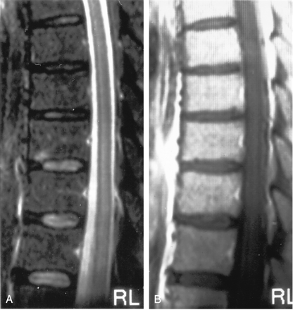 Fig 9.