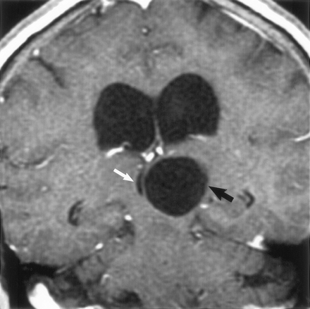 Fig 3.