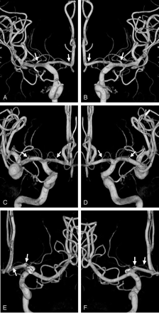 Fig 4.