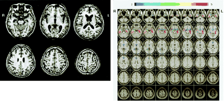 Fig 7.