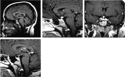 Fig 2.