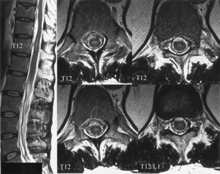 Fig 5.