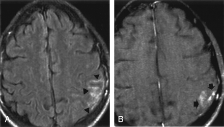 Fig 4.