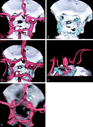 Fig 3.