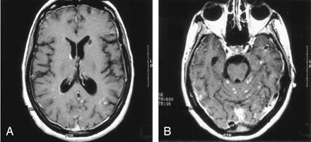 Fig 3.