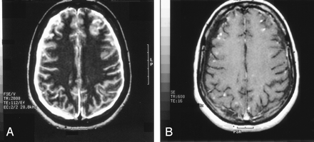 Fig 5.