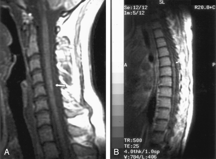 Fig 7.