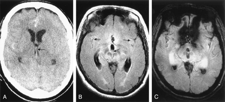 Fig 2.