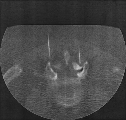 Fig 1.