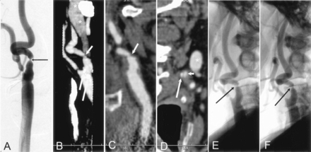 Fig 6.