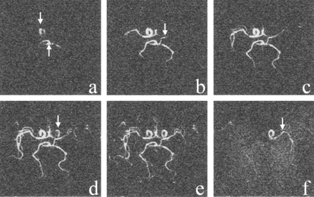 Fig 3.