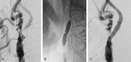 Fig 2.