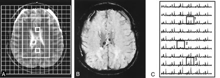 Fig 4.