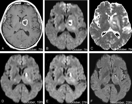 Fig 3.