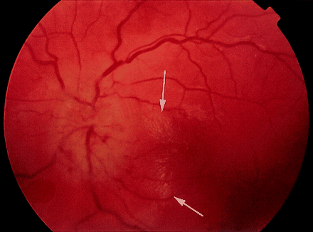 Fig 1.