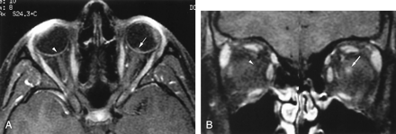 Fig 3.