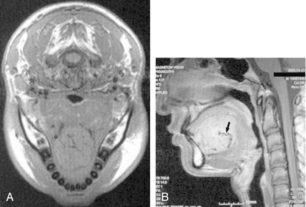 Fig 1.