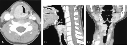 Fig 3.