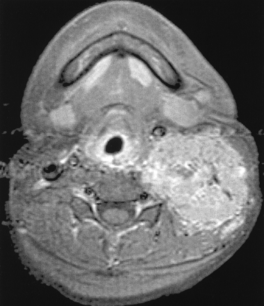 Fig 4.