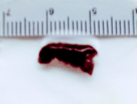 Fig 3.