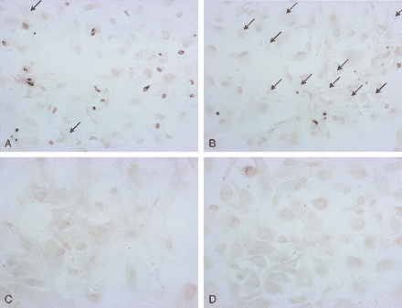 Fig 4.