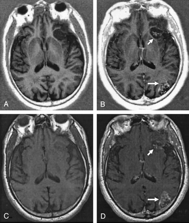 Fig 6.