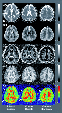Fig 3.