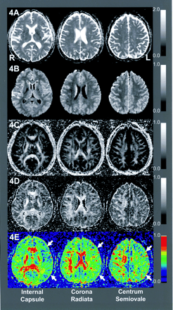 Fig 4.