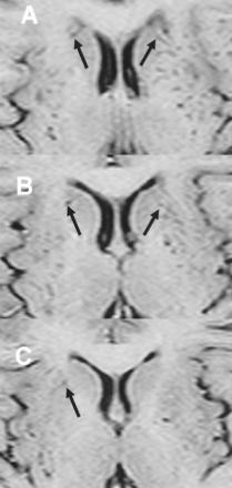 Fig 4.