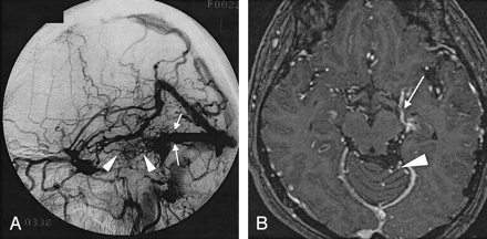 Fig 3.