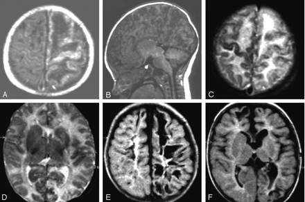 Fig 1.
