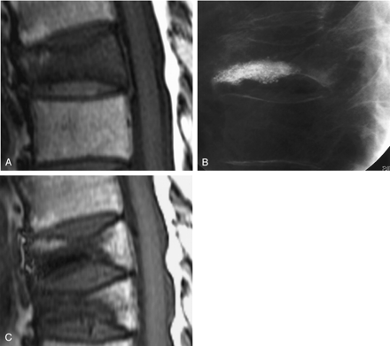 Fig 3.