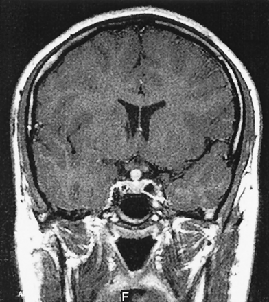 Fig 1.