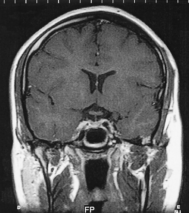 Fig 2.