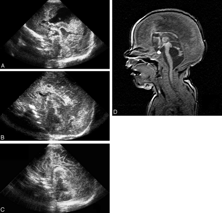 Fig 2.