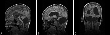Fig 3.