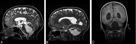 Fig 4.