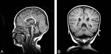 Fig 1.