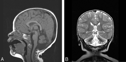 Fig 2.