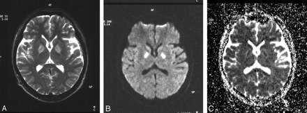 Fig 1.