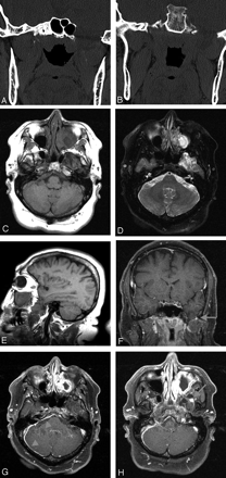 Fig 1.