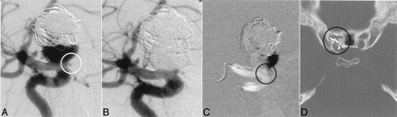 Fig 2.