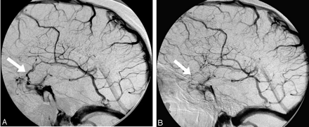Fig 4.