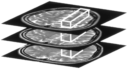 Fig 3.